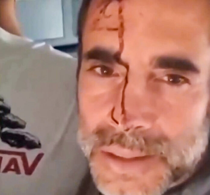 herido300926_f1